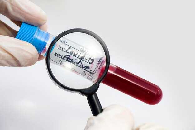 Различия между антителами IgG и IgM