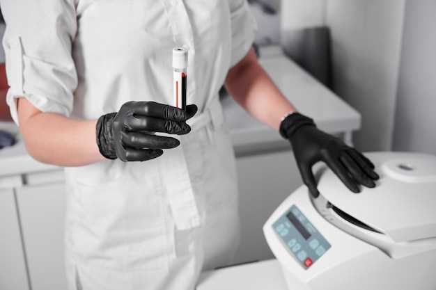 Значение билирубина в биохимическом анализе крови