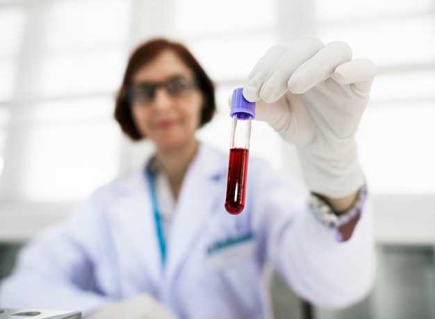 Важность исследования биохимии крови