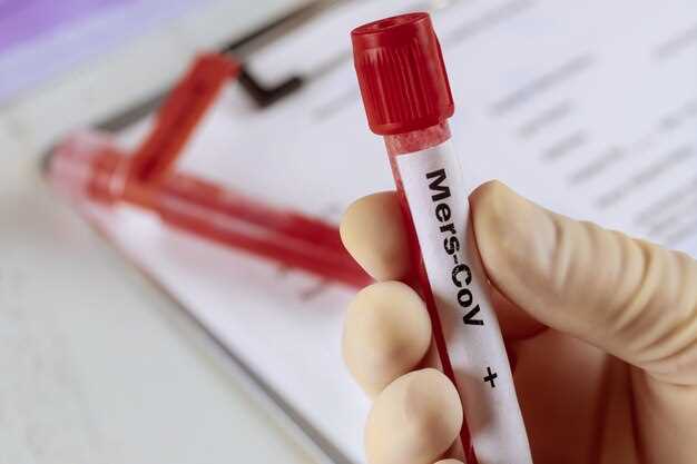 Как получить результат анализа крови на сифилис