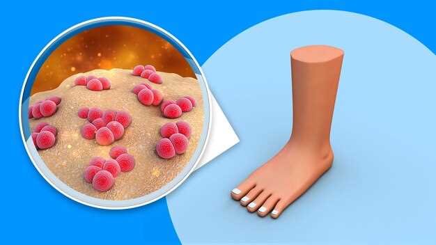Симптомы и причины грибка на ступнях ног