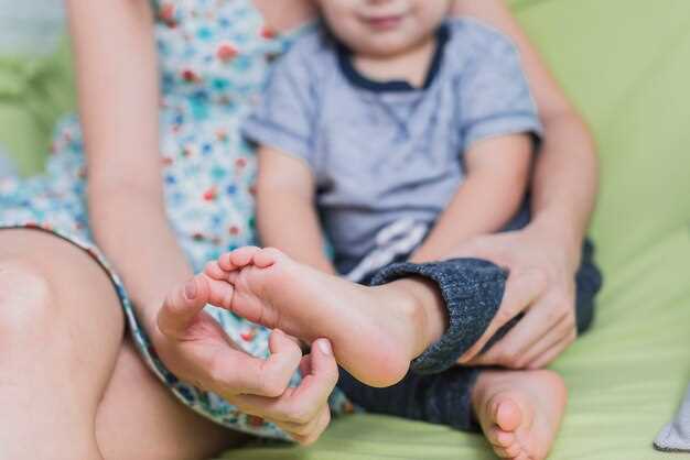 Как распознать грибок у ребенка на ногах