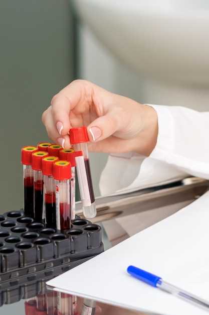 Подготовка к анализу крови