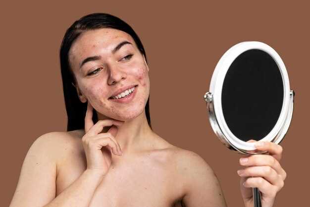 Народные методы и домашние рецепты
