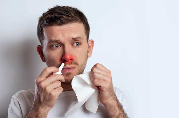 Профилактика кровотечения из носа
