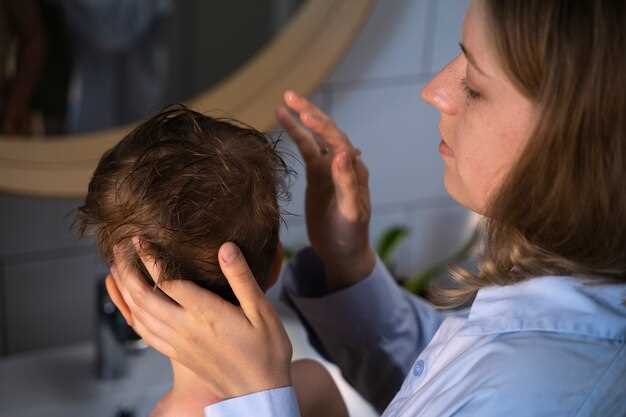 Себорея на голове: симптомы и причины