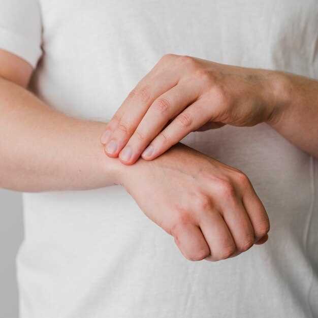 Причины и симптомы аллергии на руках
