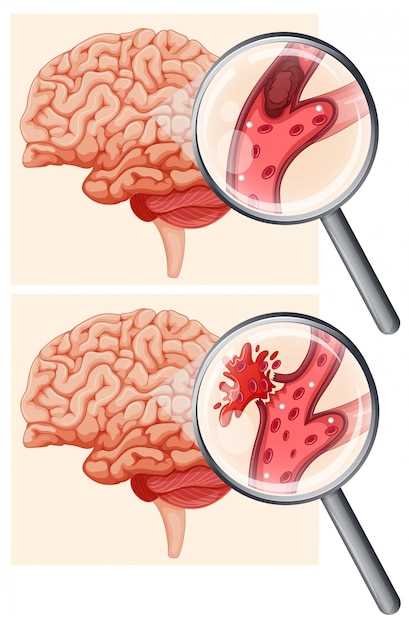 Как диагностируется киста головного мозга: методы и процедуры
