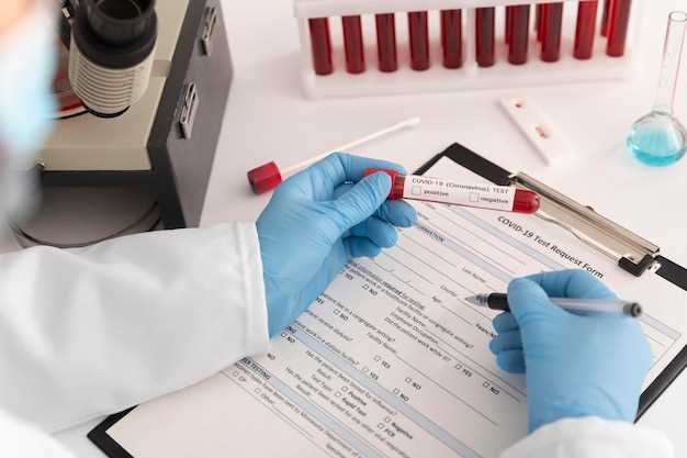 Как анализ крови диагностирует аутоиммунное заболевание