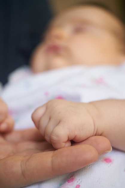 Опрелости у новорожденного: причины и симптомы