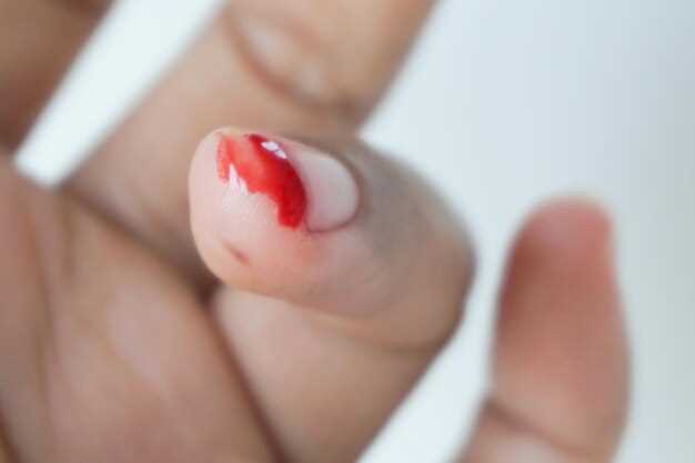 Влияние диабета на гемостаз