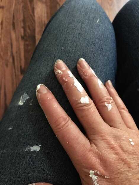 Причины появления белых точек под ногтями