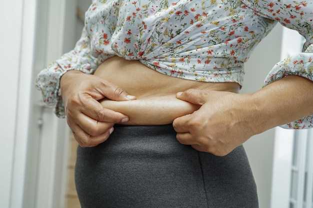 Причины накопления жира на животе у женщин